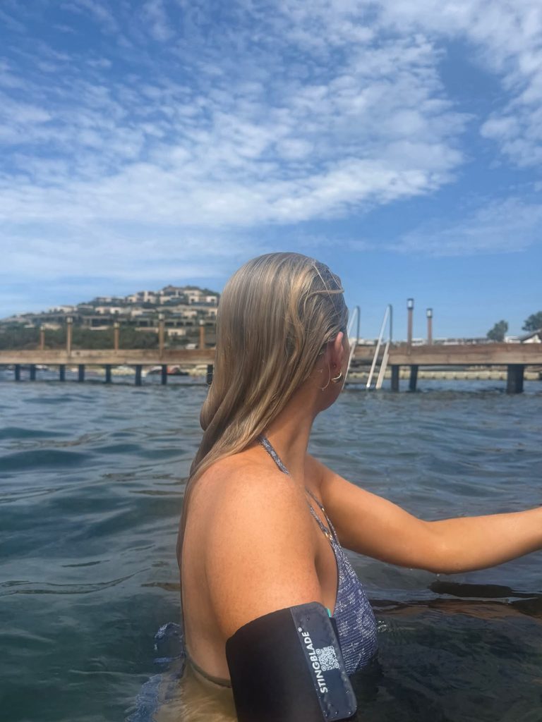 a photo of a woman with a stingblade personal attached to her arm